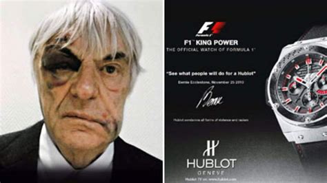 F1 Boss Bernie Turns Mugging To Ad